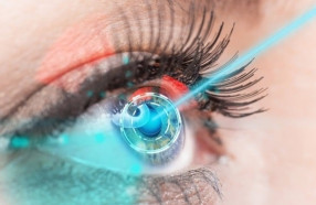 Как долго держится эффект лазерной коррекции зрения