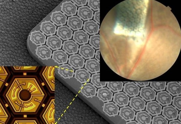 Photovoltaic retinal prosthesis