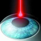 PTK (Phototherapeutic keratectomy)