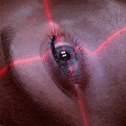 chto takoe lasik1