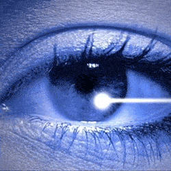 lasik kak provod