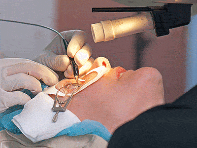 lasik kak provod1
