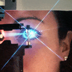 reabil lasik1