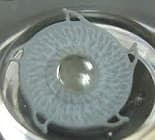 Artificial iris implantation  