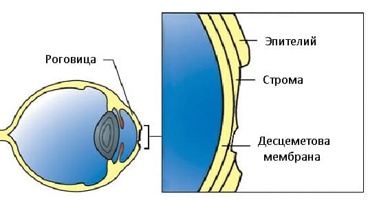 Язва роговицы фото