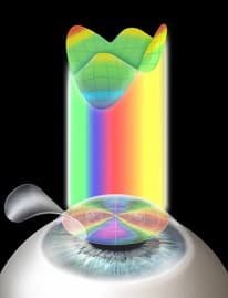 Super LASIK