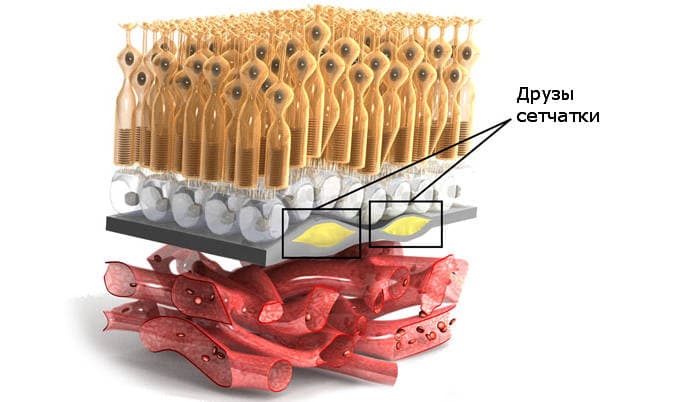 Друзы сетчатки глаза