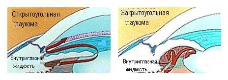 Схема оттока внутриглазной жидкости