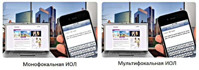 Мультифокальные хрусталики ИОЛ - отзывы и цены