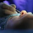 Sinus trabeculectomy