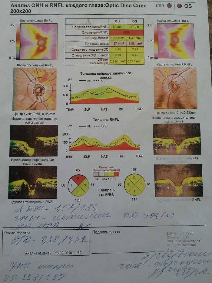 Диагноз по данным HRT