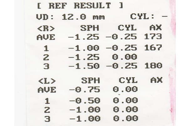 Cyl в офтальмологии. Расшифровка показателей авторефрактометрии. Расшифровка показания авторефрактометра. Показатели зрения с аппарата расшифровка. Рефрактометр распечатка расшифровка.